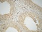 FAS Polyclonal Antibody